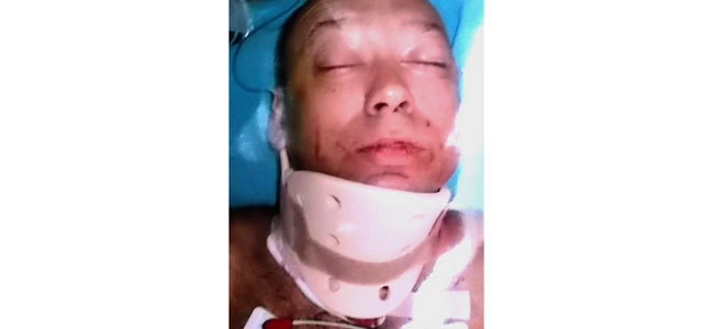 Русский турист во Вьетнаме ударил лучшего друга ножом в горло